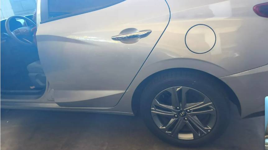 Hyundai HB20S Limited 1.0 TB Flex 12V Aut. 2026 - Imagem 6